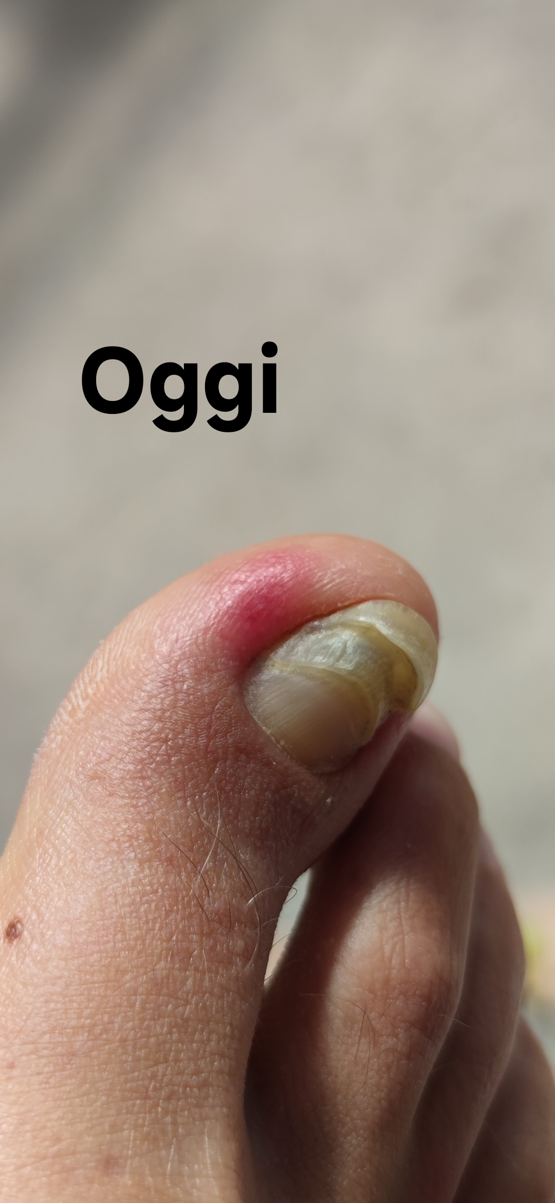 Allegato immagine