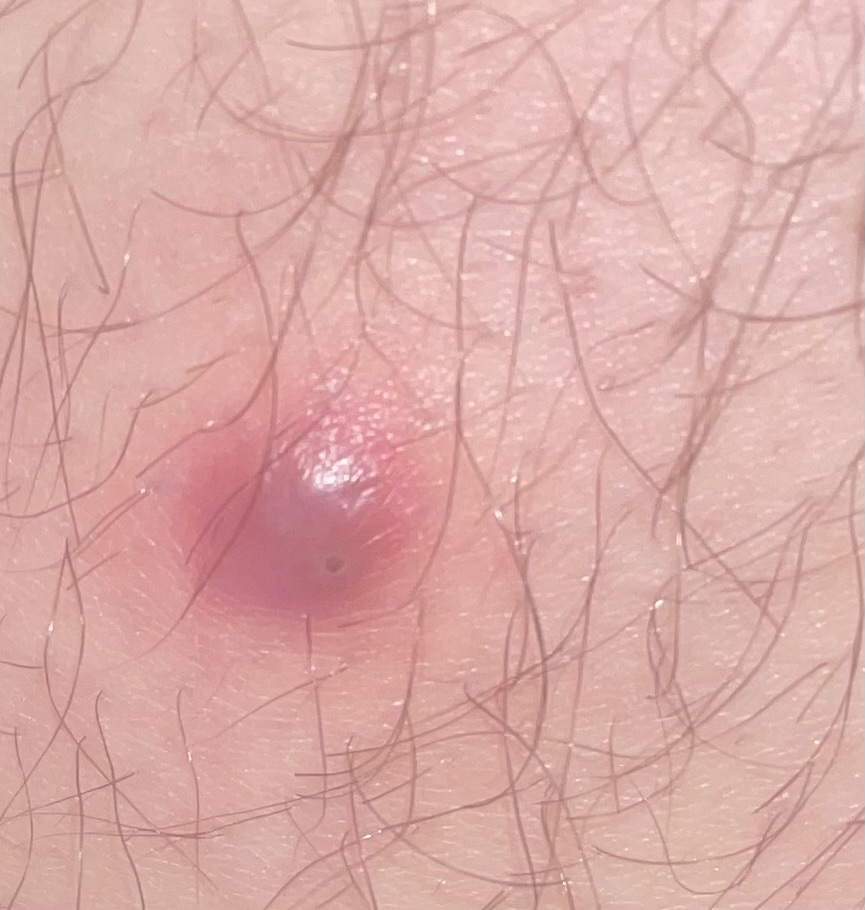 Allegato immagine