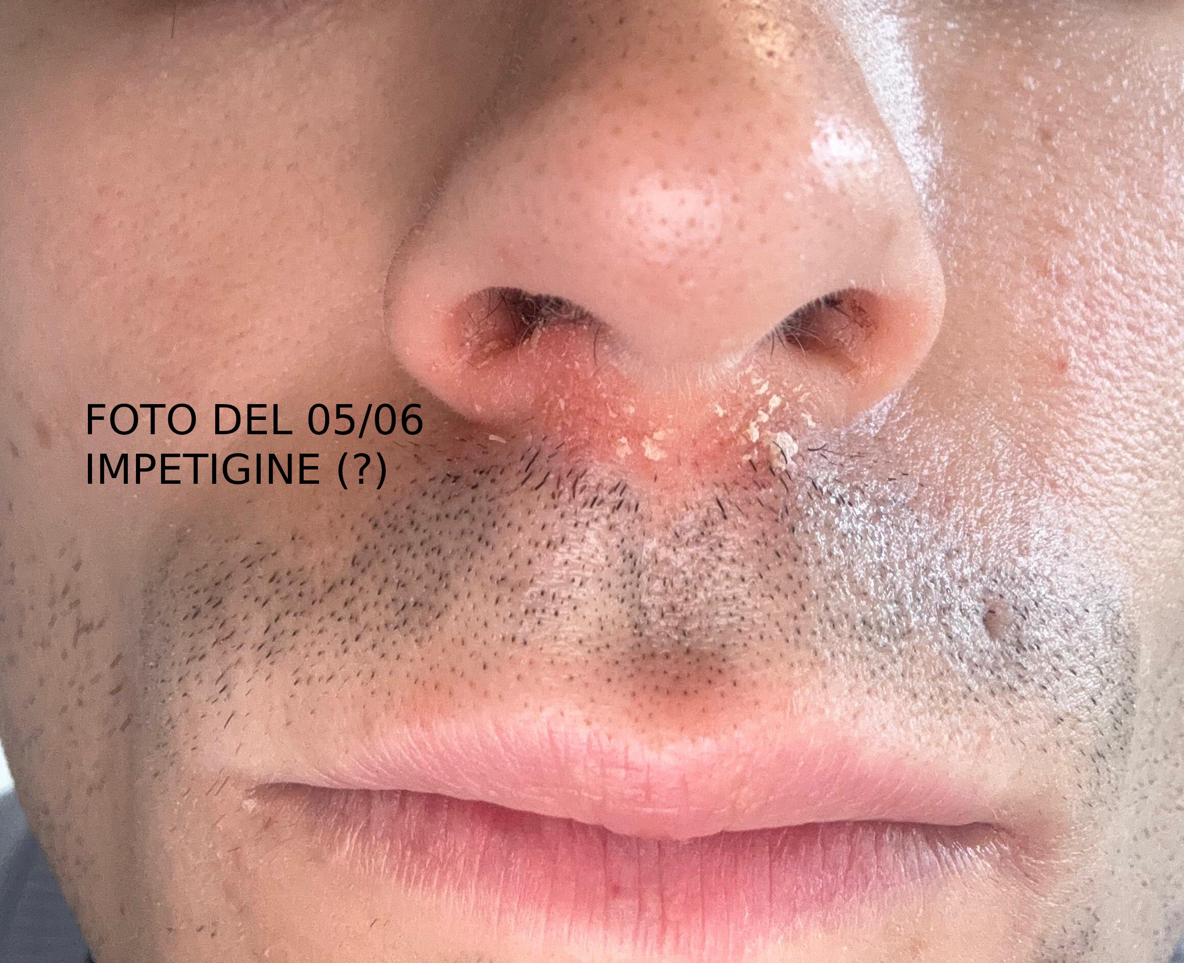 Allegato immagine
