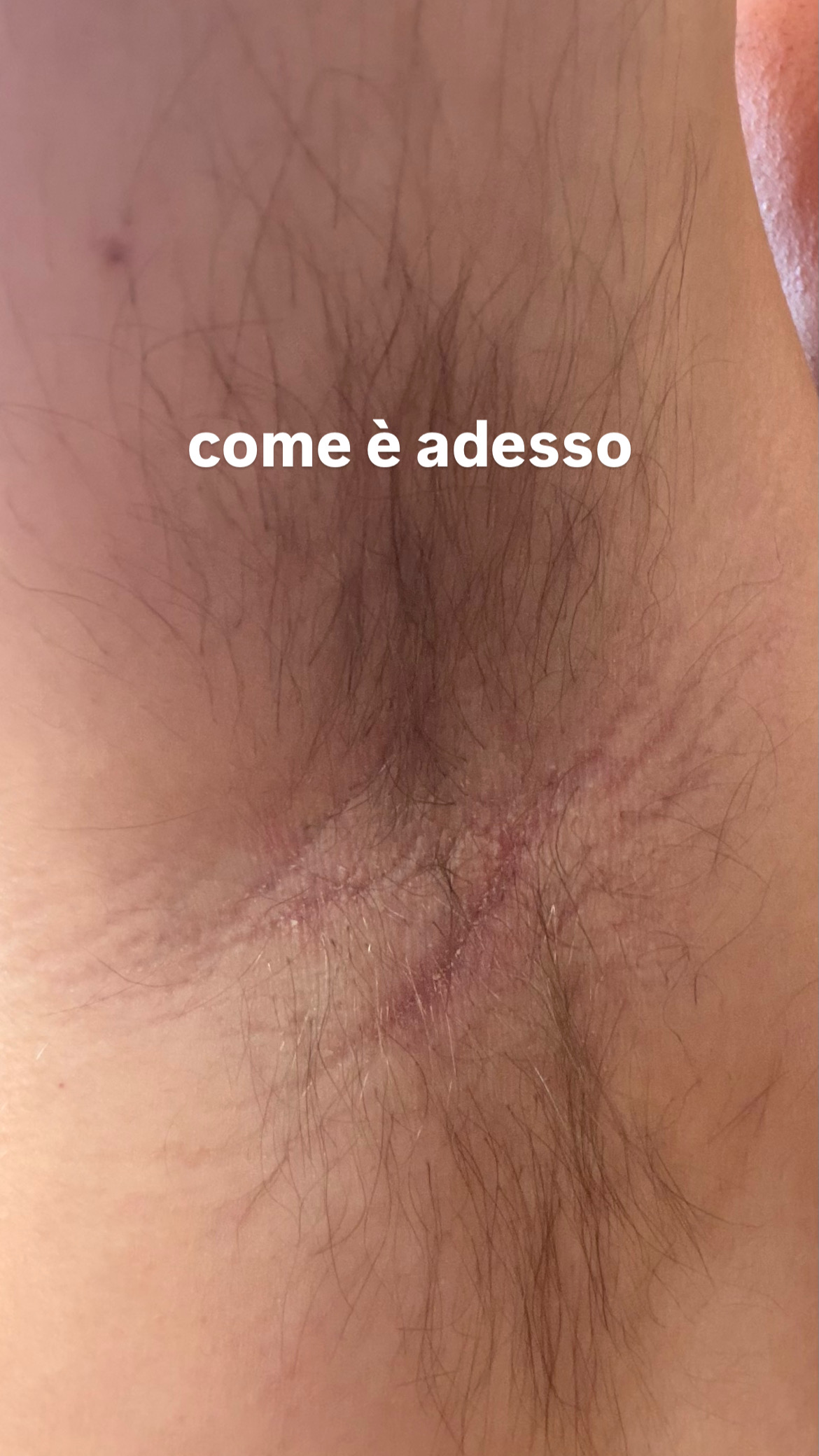 Allegato immagine